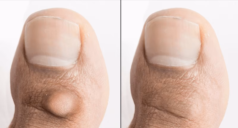 Minor Ops Before After results