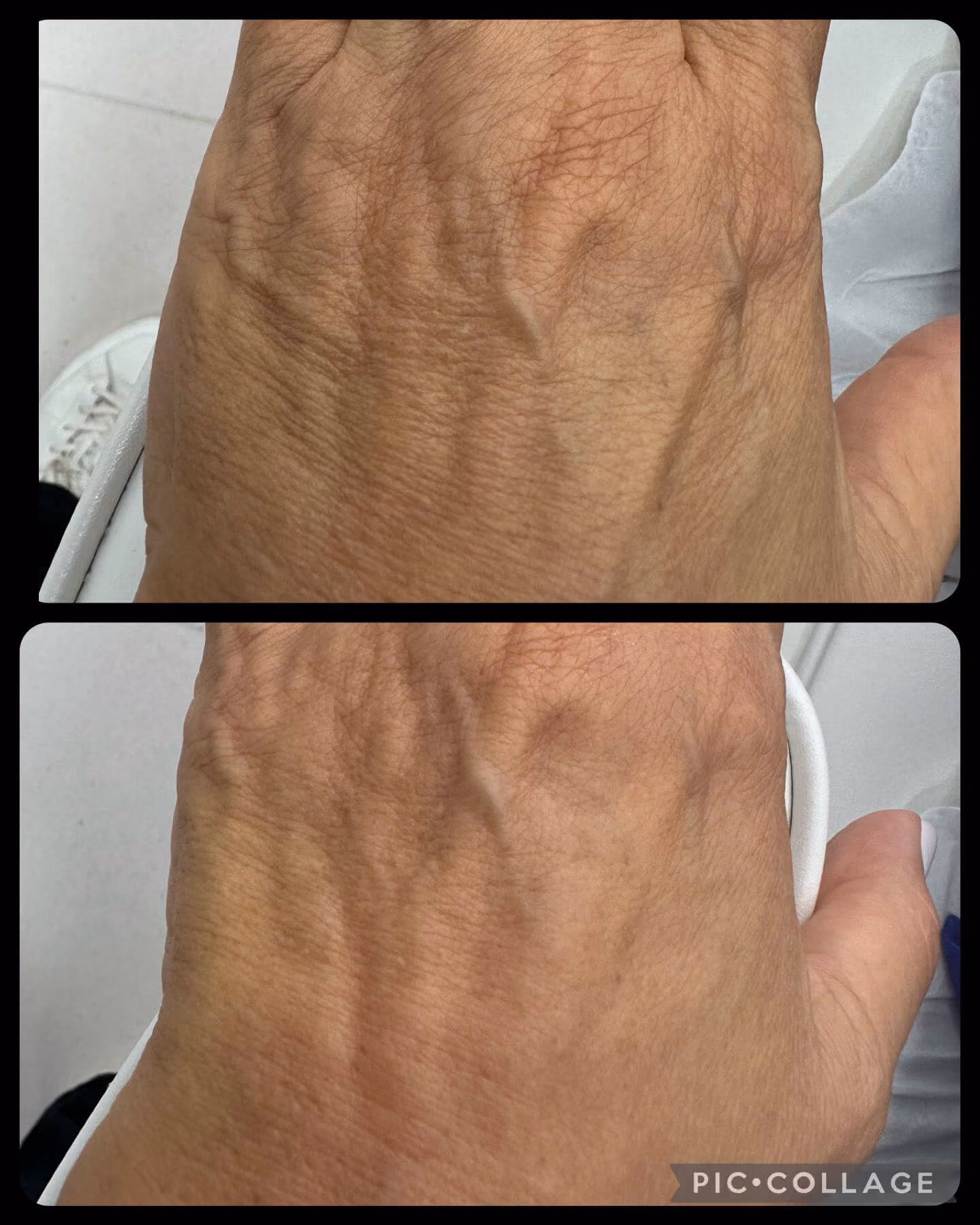 Before & After Results