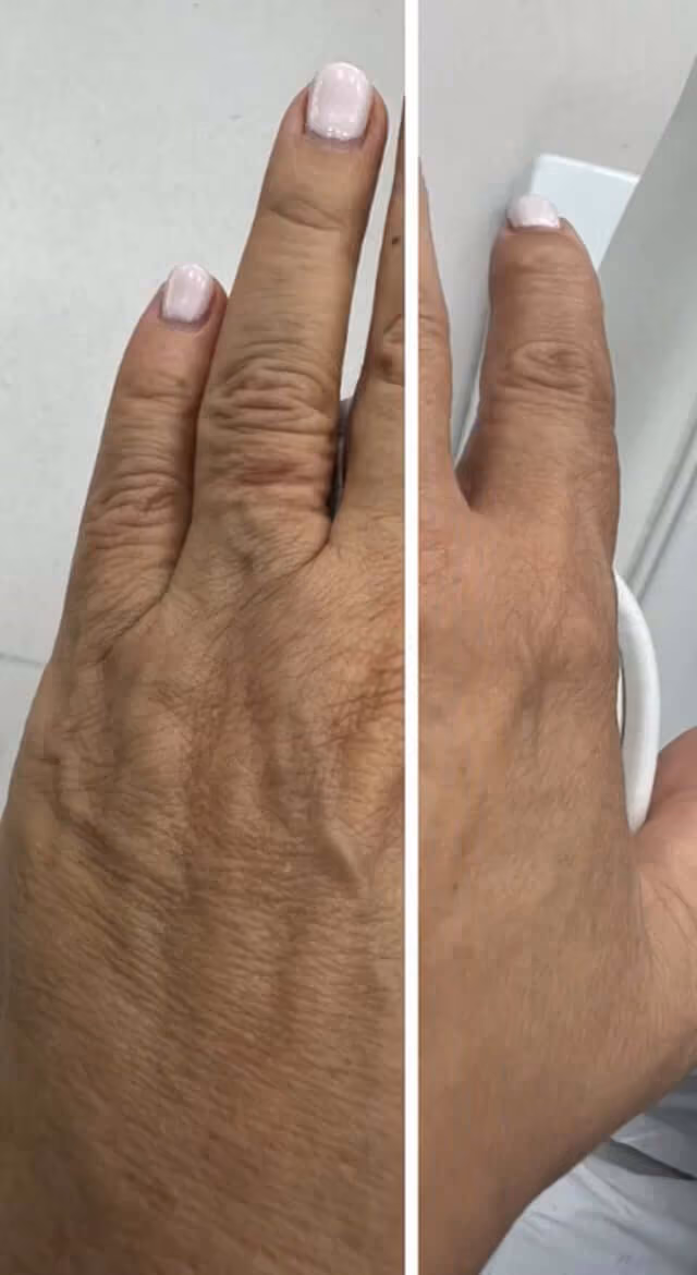 Before & After Results