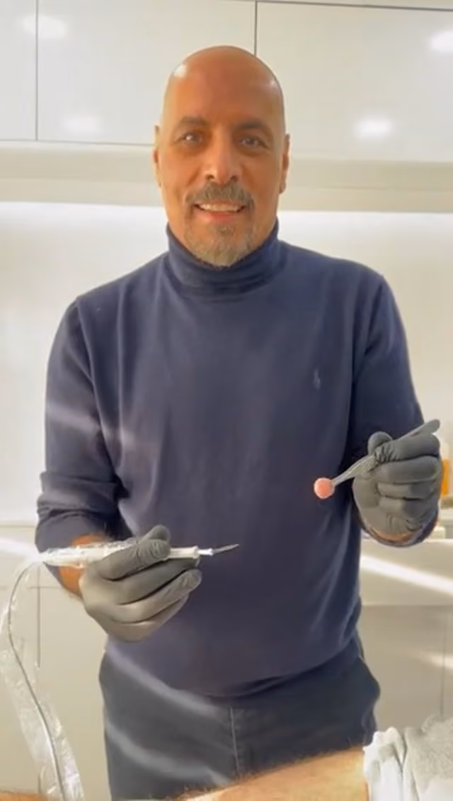 Wart Removal 