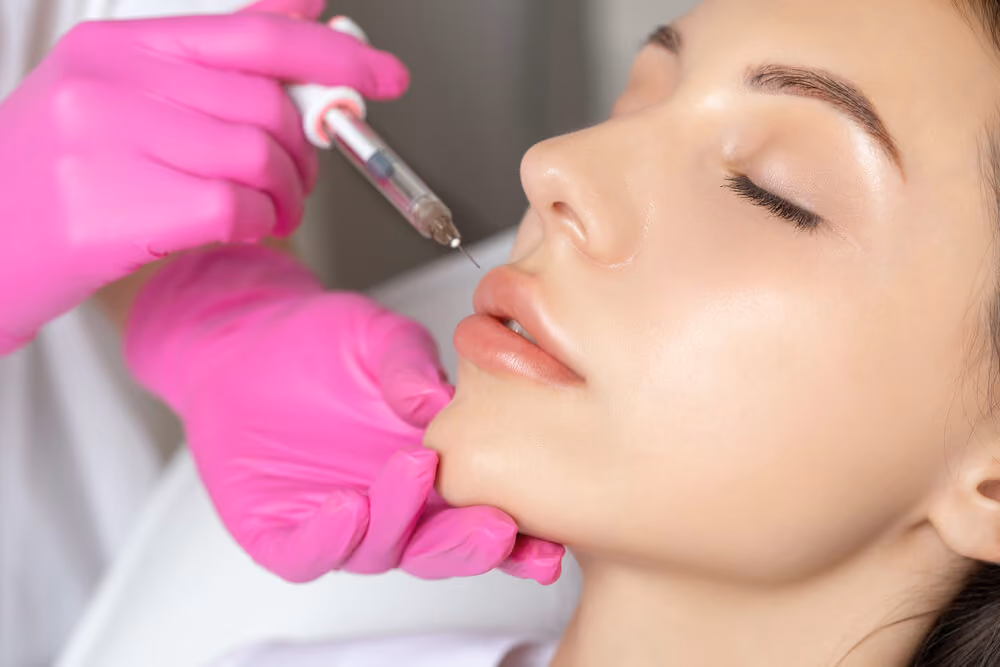 Lip filler treatment Solihull – improved definition and volume