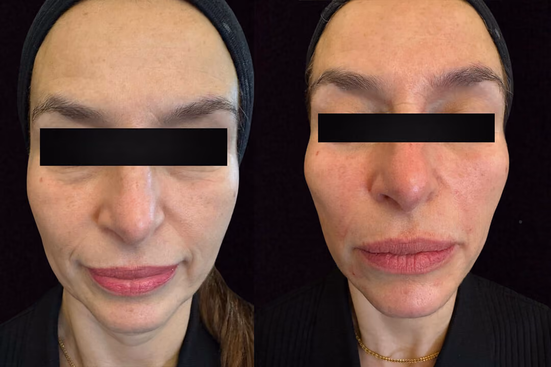 AL Aesthetics Solihull clinic consultation booking