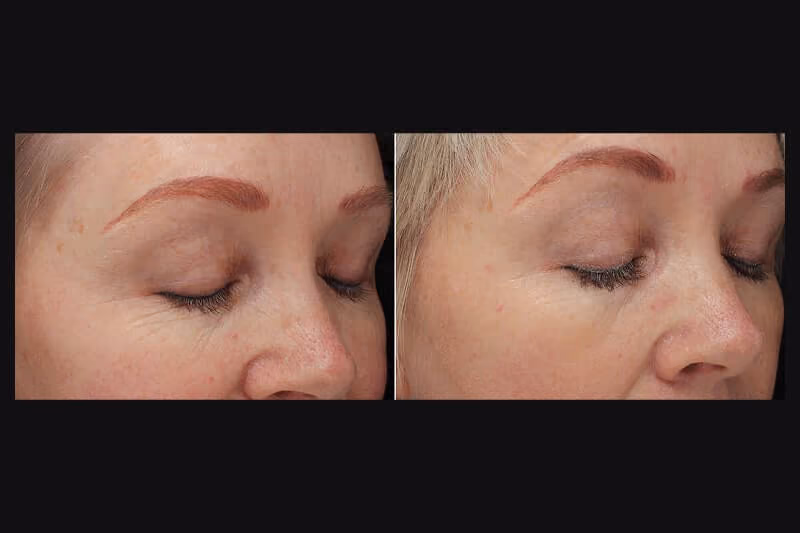 Treatment results