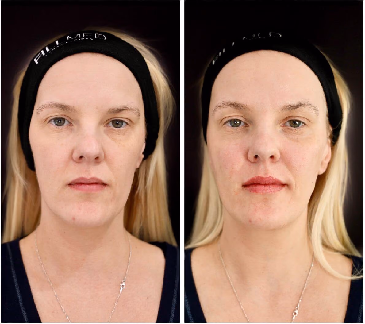 AL Aesthetics Solihull clinic consultation booking