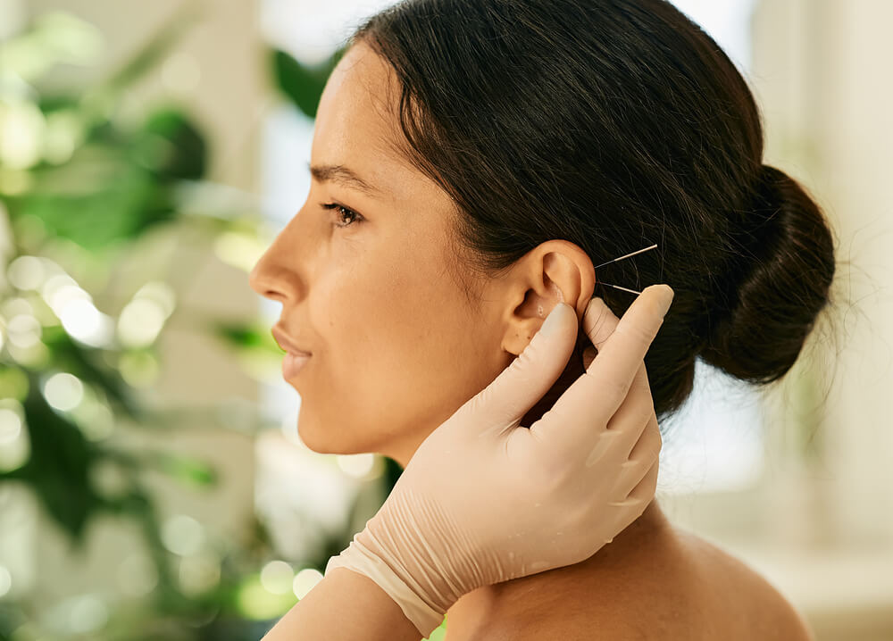 Auricular Acupuncture Solihull