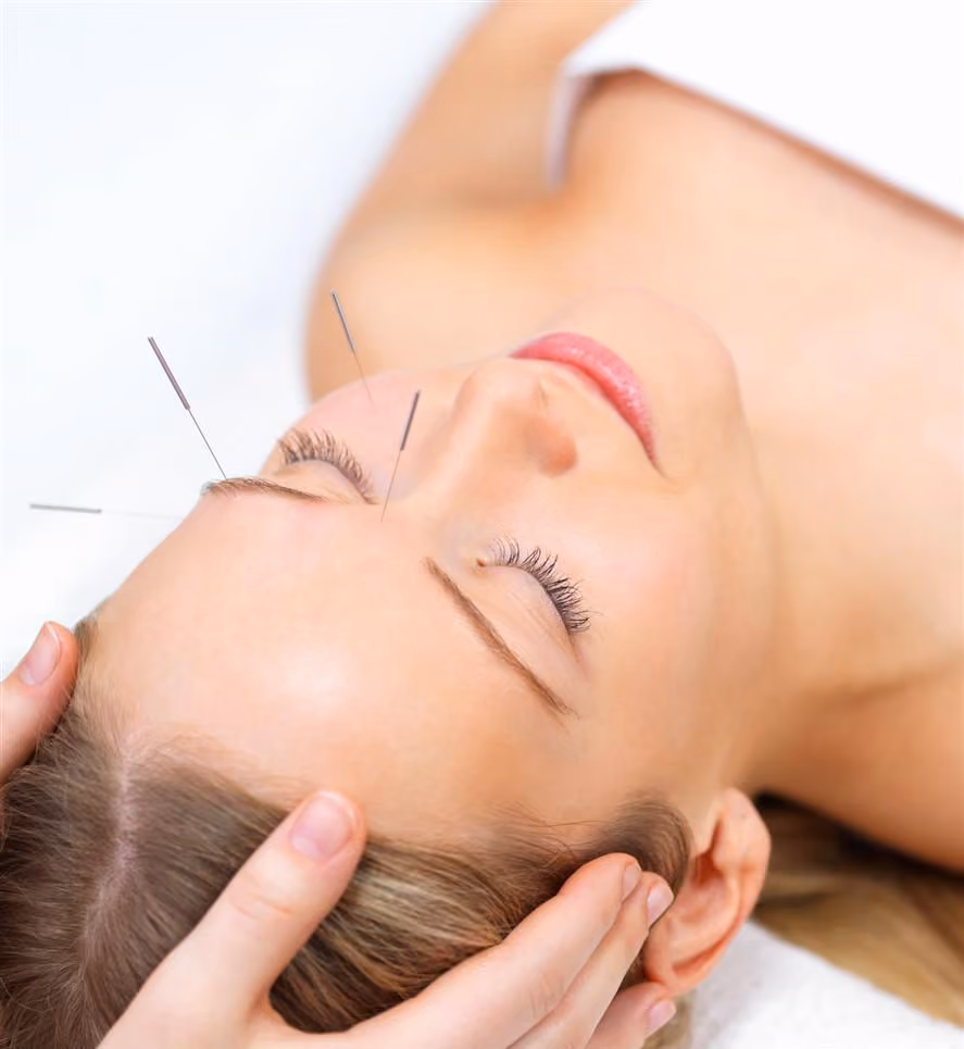 SkinPen Treatment
