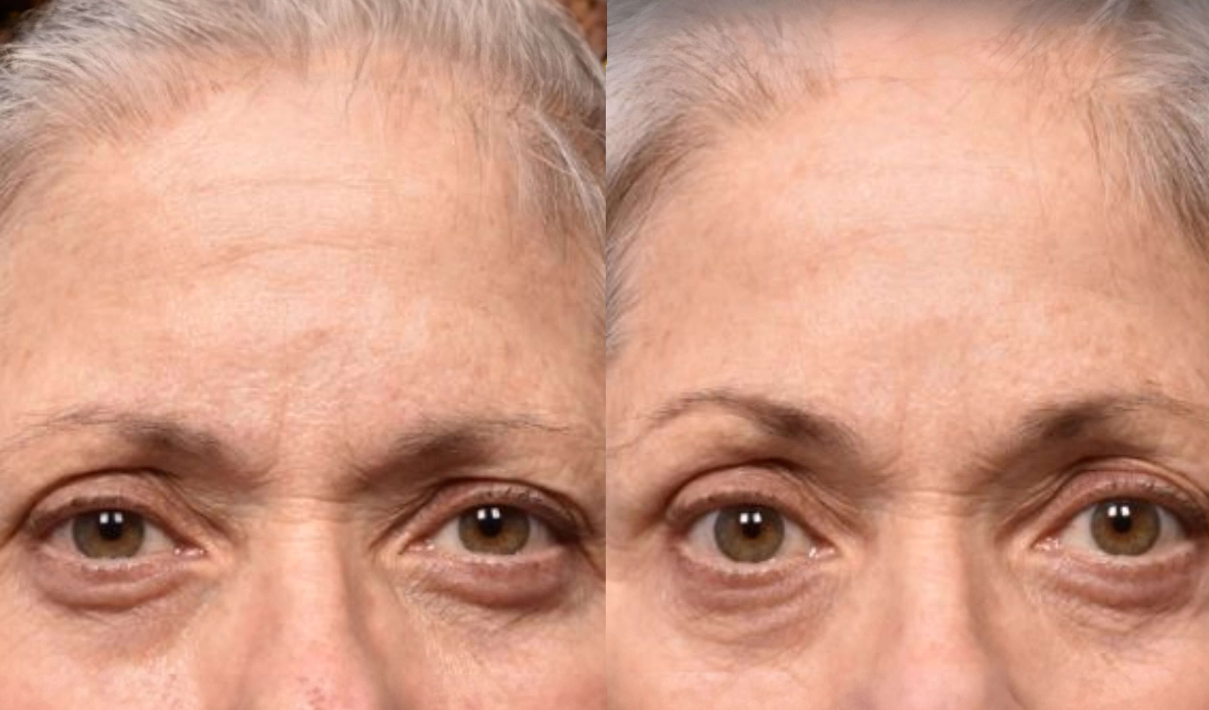 Before and After Treatment