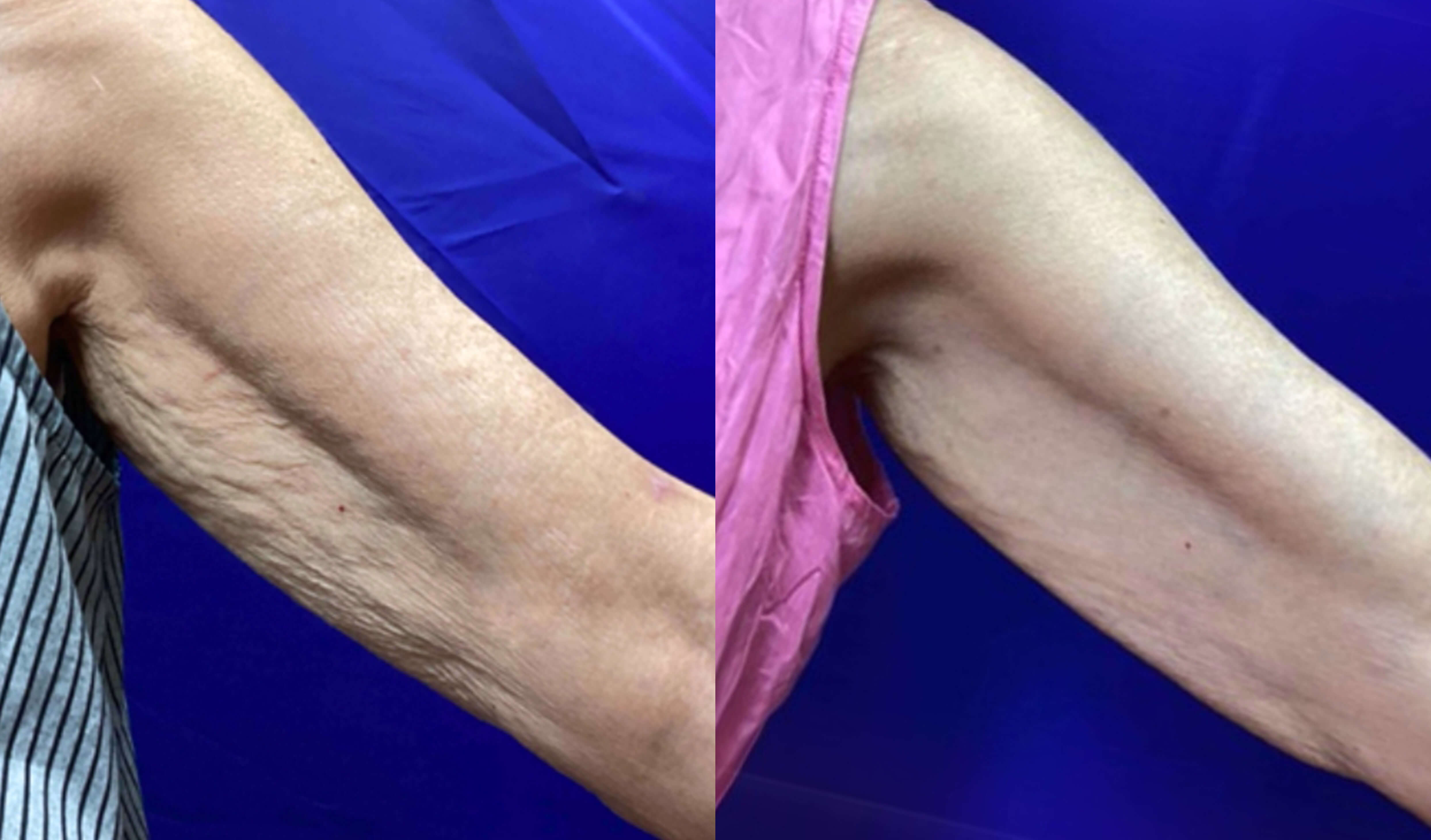 Before and After Treatment
