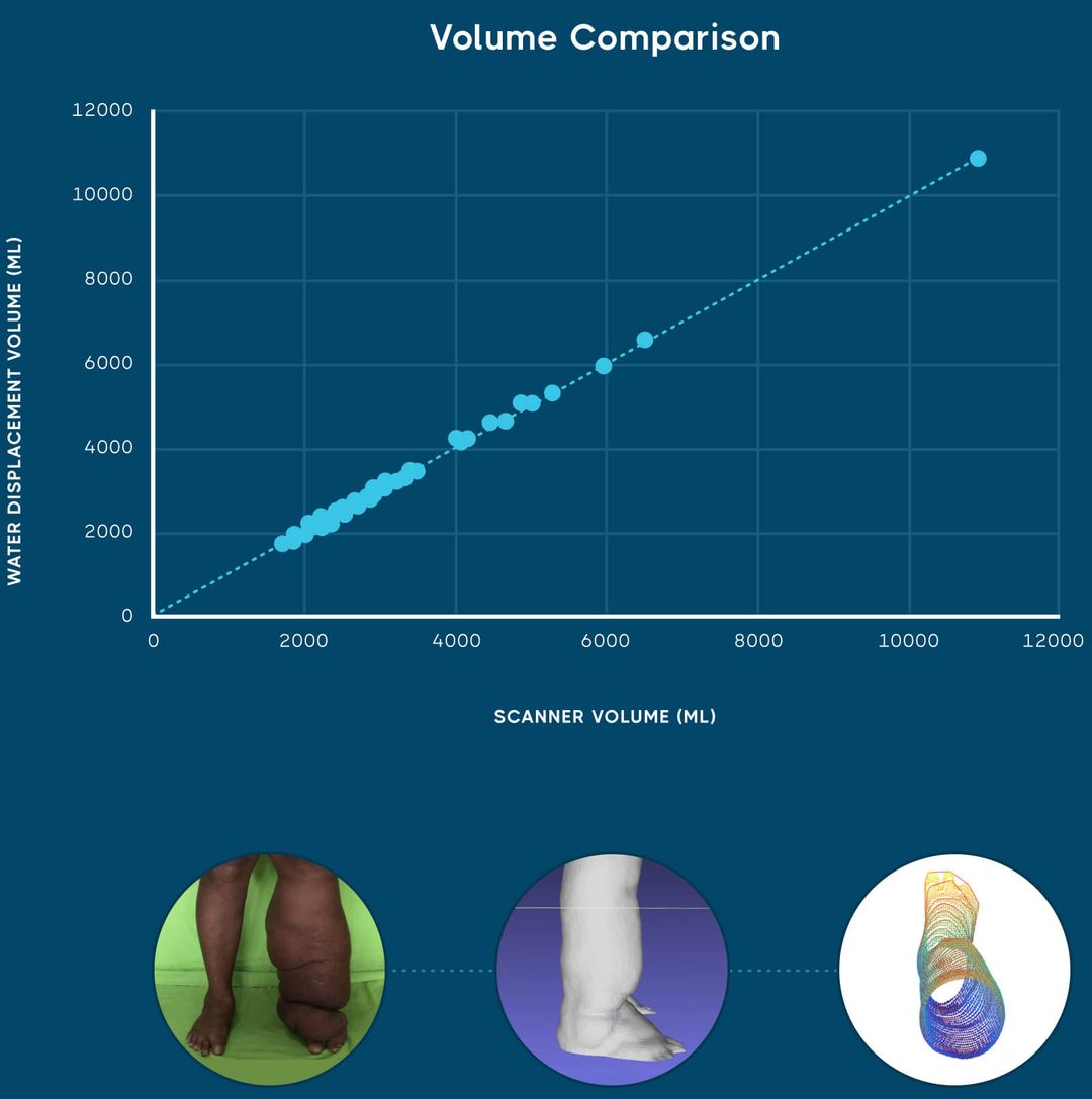 LymphaTech | Accurate, reliable 3D measurement for lymphedema