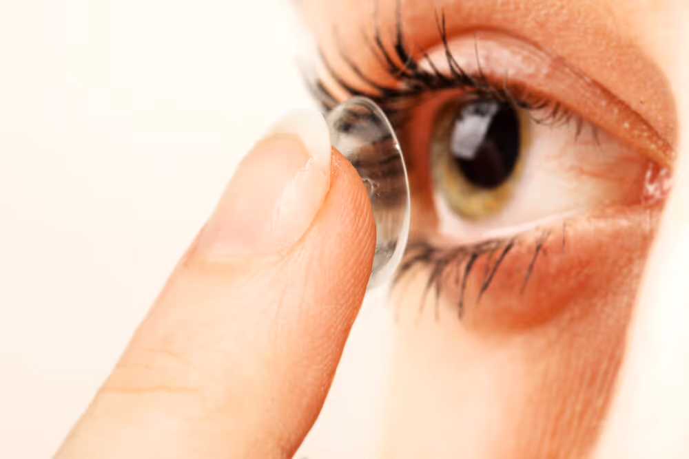 Sports and Contact Lenses. Contact lenses sit directly on the cornea