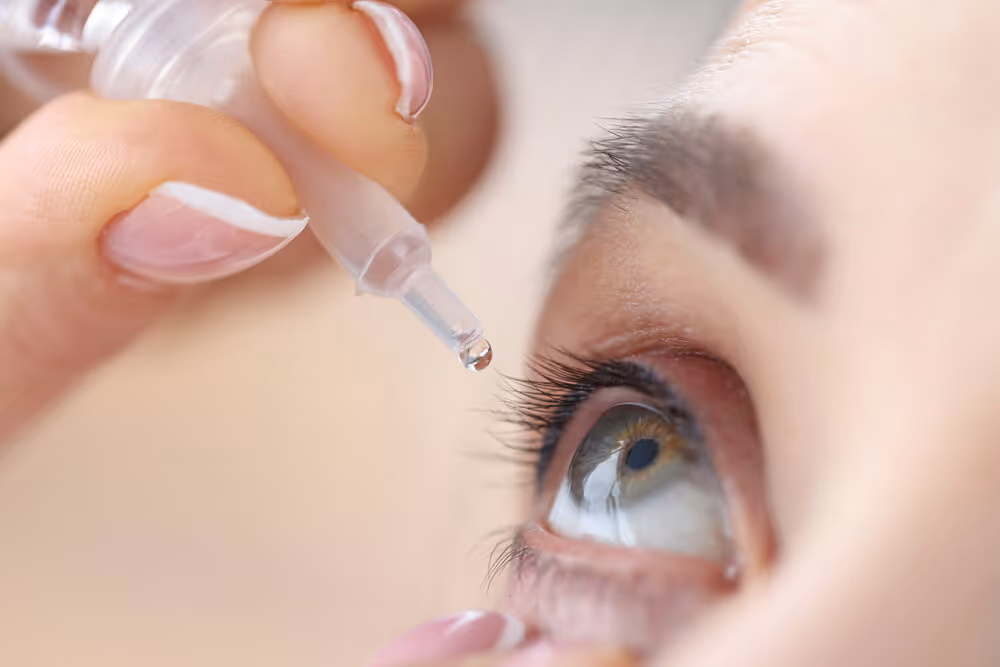 Dry Eye Syndrome. Drops being placed in eye.