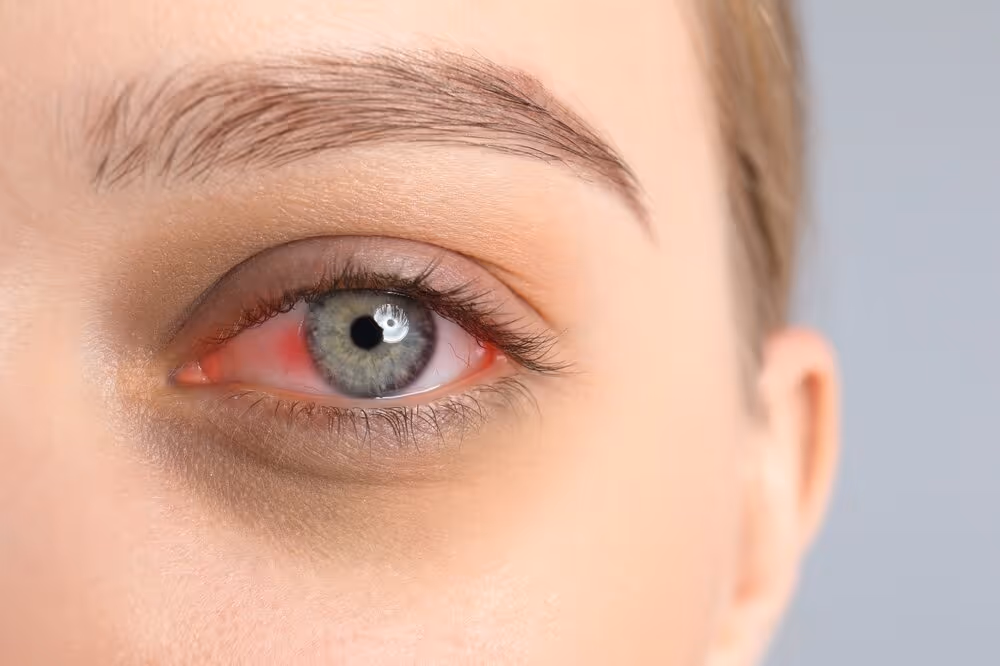 Effective Dry Eye Treatment