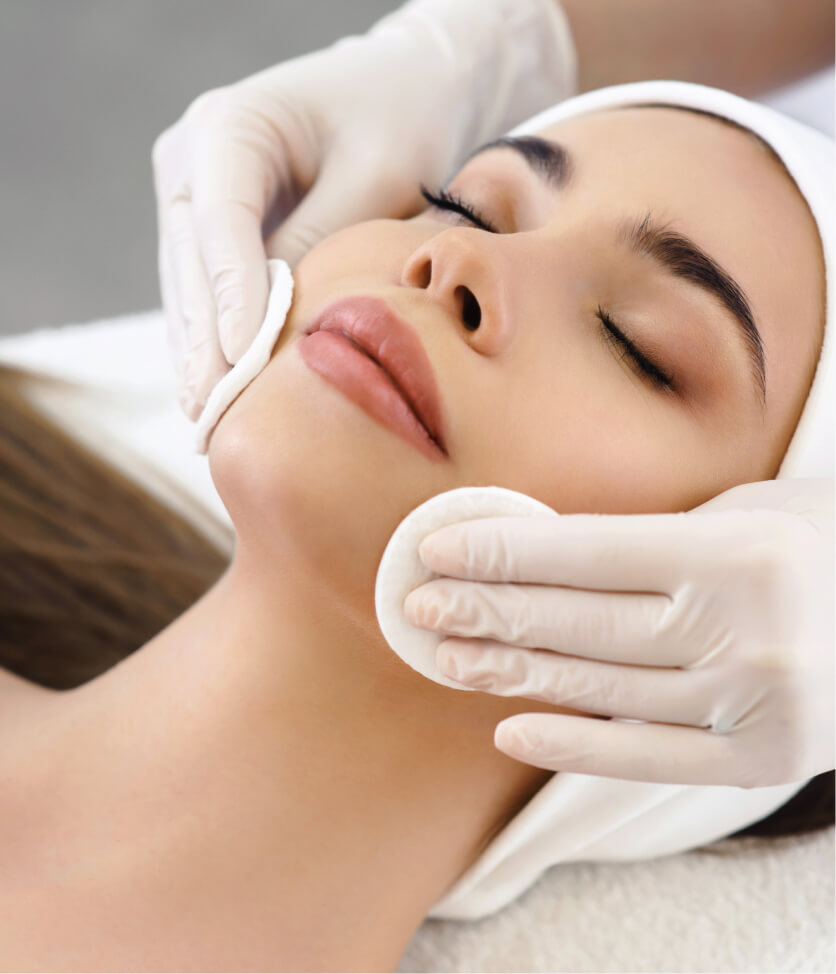 Chemical Peel