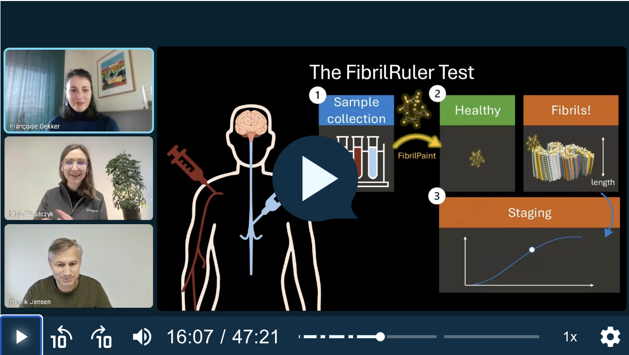 Early detection and monitoring of Parkinson's disease. A 