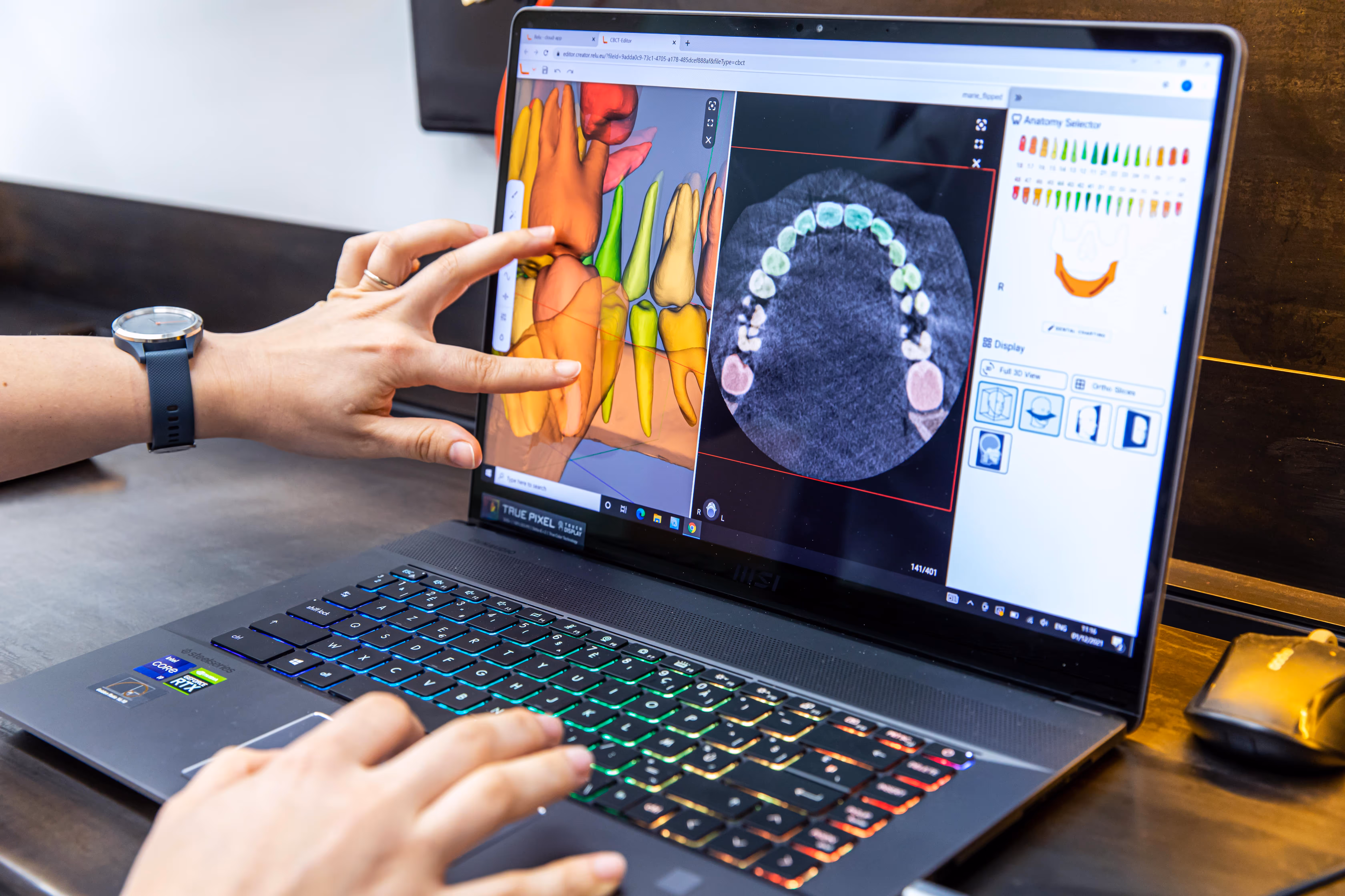 Leverage the capability of the Relu® Engine to create a digital twin of the patient to increase treatment conversion rates.