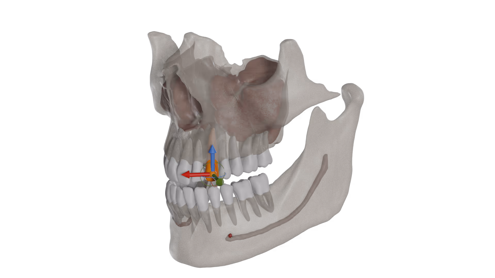 Increase the predictability of the treatment plan by including CBCT. 