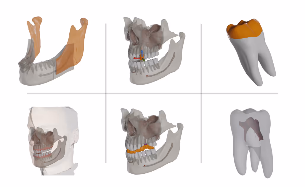 If you are developing a software that can benefit from CBCT, digital impressions or facial scans, then make sure to reach out for a chat.