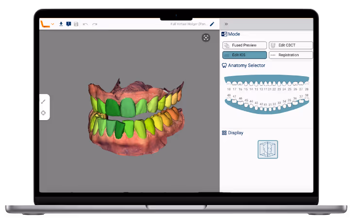 Computer screen showing Relu® Creator software used to visualise and segment digital impressions or intra-oral scans