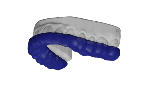 splint