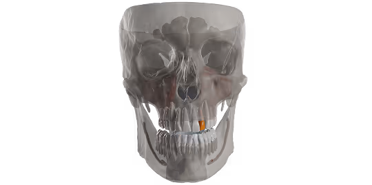 Dental segmentation and alignment