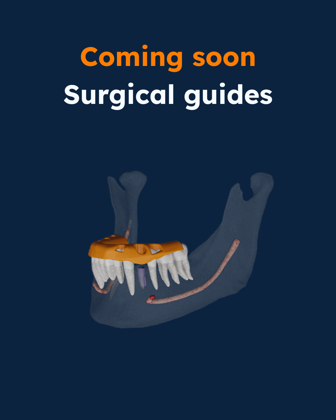 dental splints