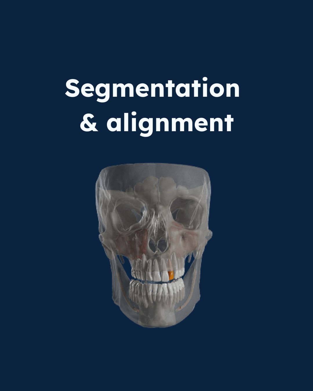 dental segmentation and alignment