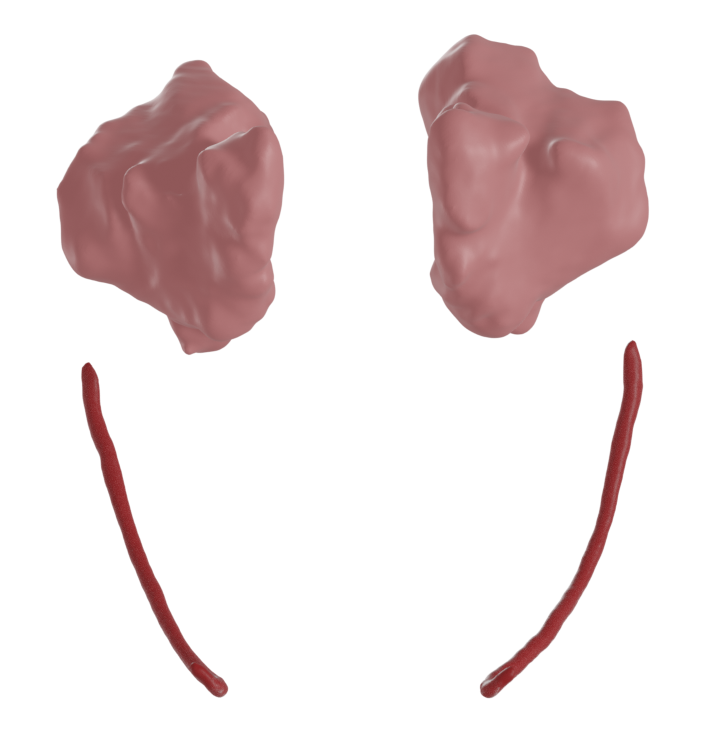 Nerves and sinuses segmented from CBCT