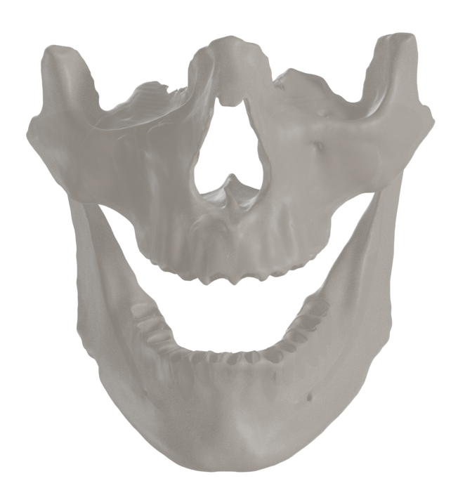 Mandible and Maxilla segmented from CBCT