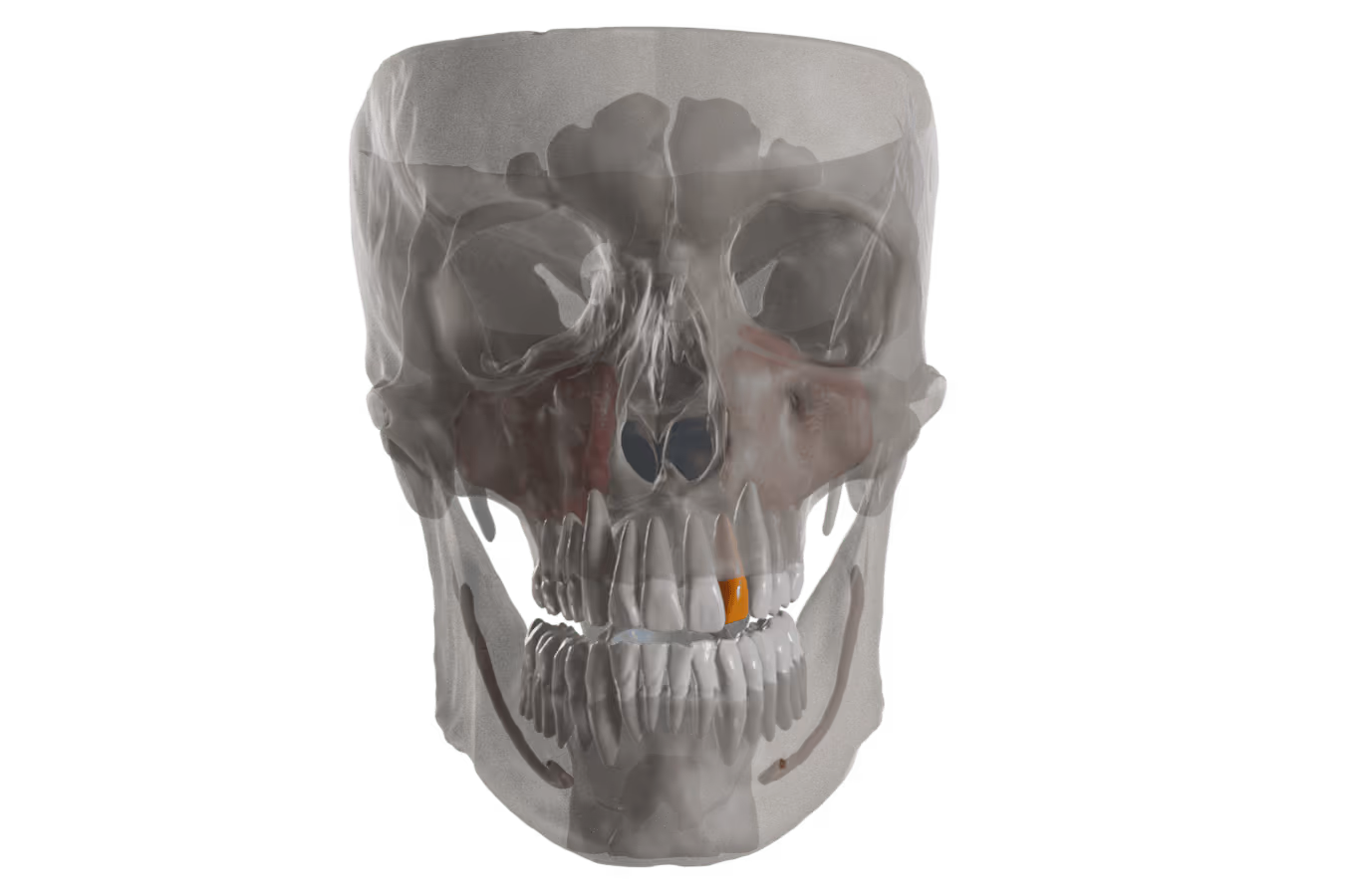 dental segmentation and alignment
