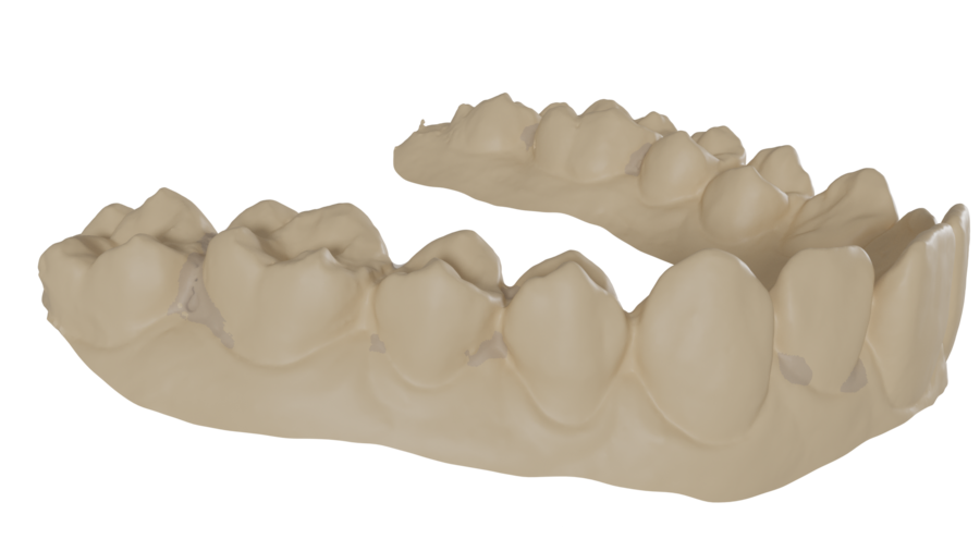 Used by dental laboratories worldwide to automate routine crown and bridge cases while maintaining full technician control.
