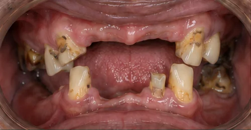 before and after treatment