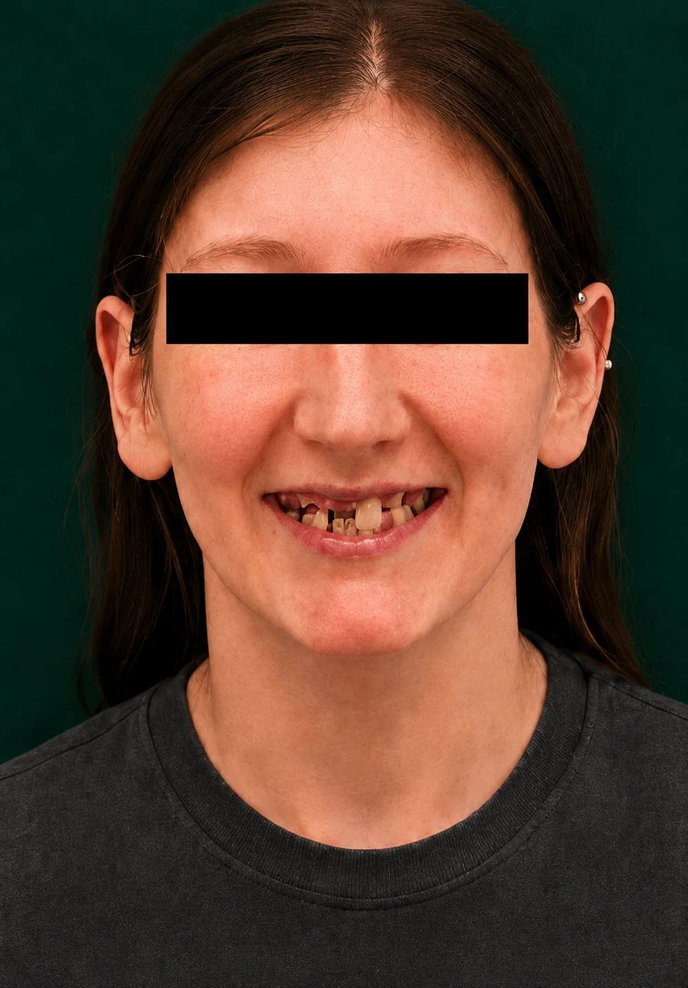 before and after treatment