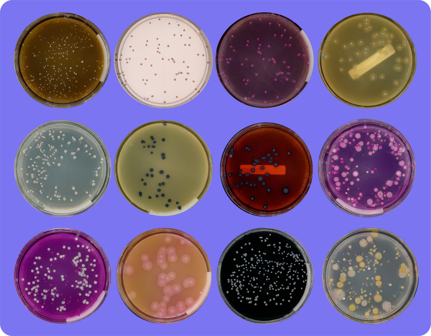 Different types of rapid tests and agar types associated with plate-based microbiology testing