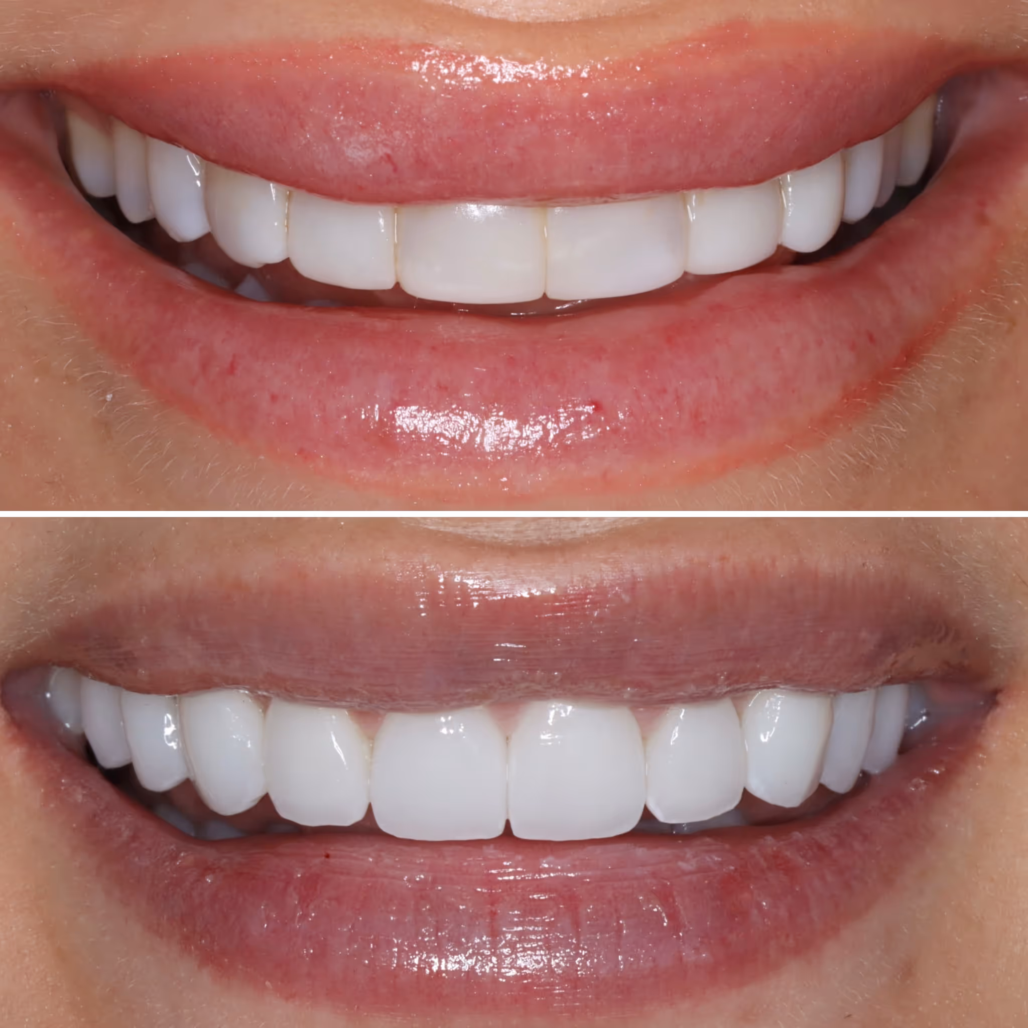 Before and after image