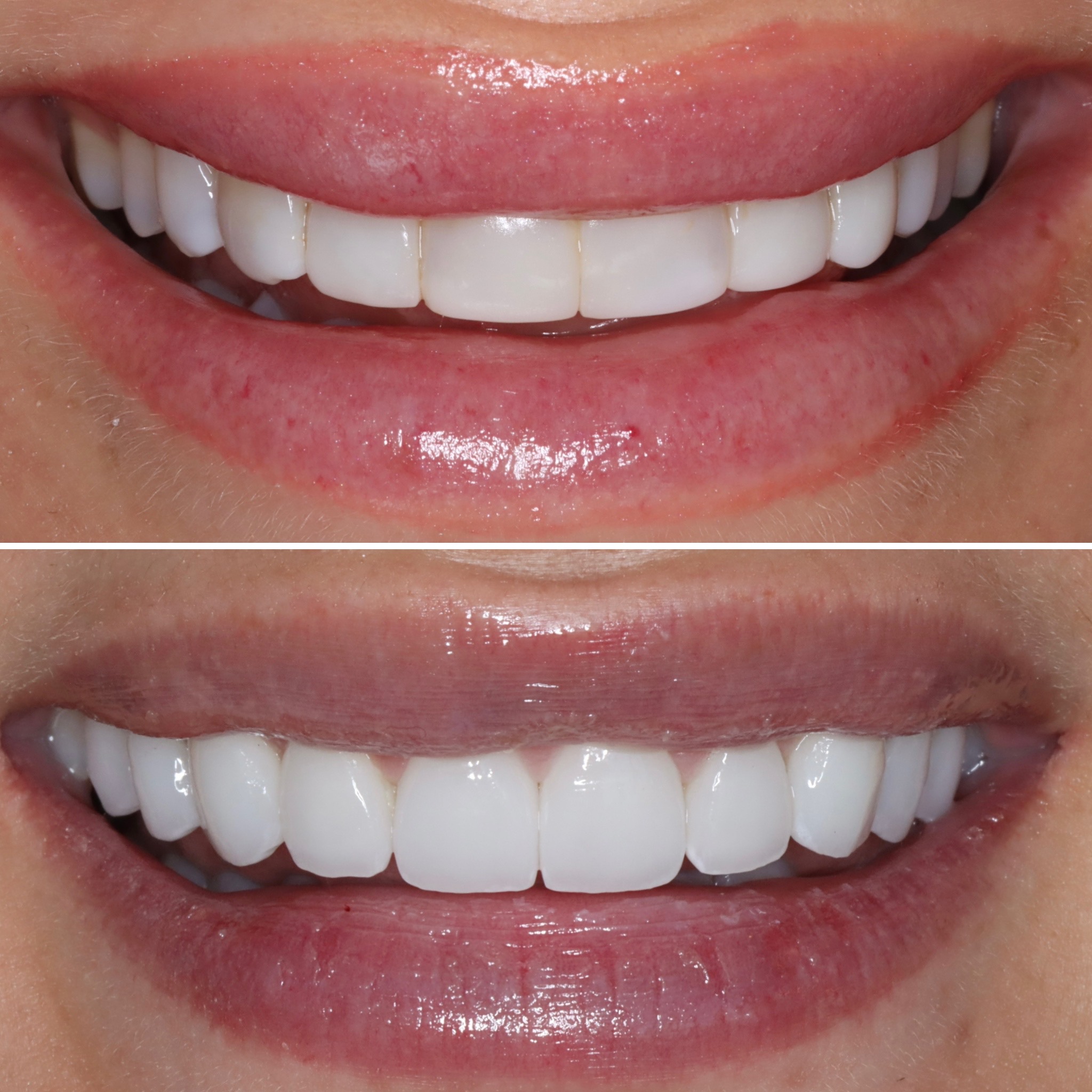 Before and after image