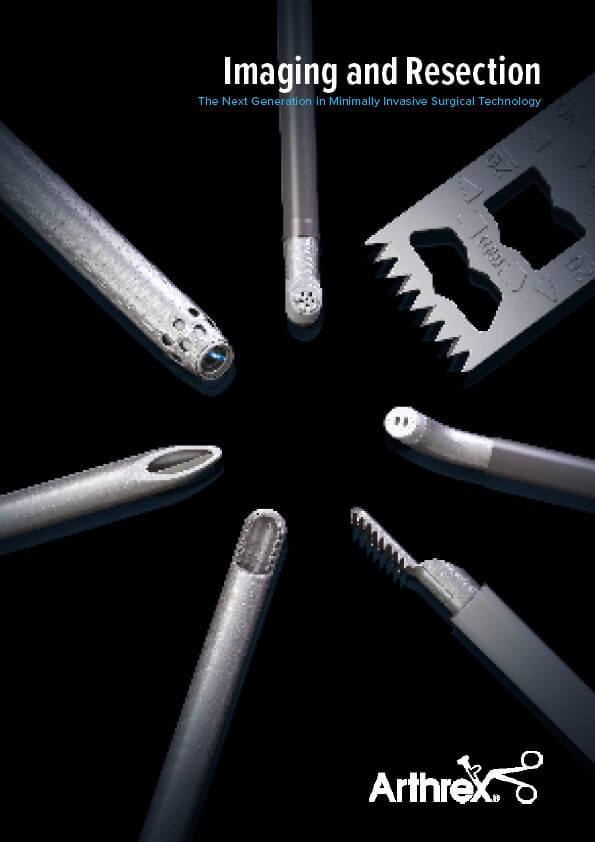 Imaging and Resection