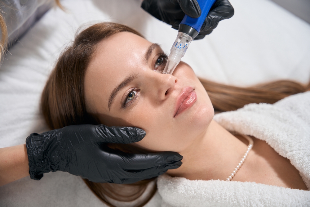Refresh, Renew, Reveal: Why Spring Is the Perfect Time for SkinPen® Microneedling