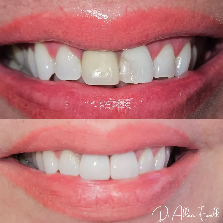 Patient reviews - Excite Dental of Laurel