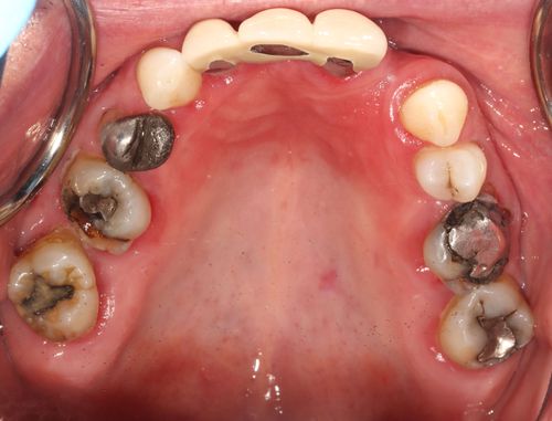 Before Restorative Dentistry