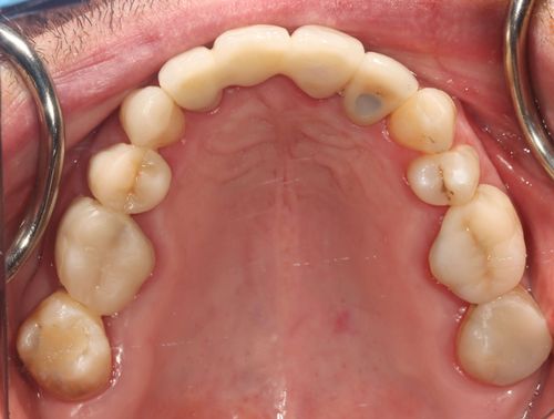 After Restorative Dentistry