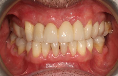 After Restorative Dentistry