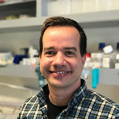 Precision Strategies for Self-Reactive T Cells