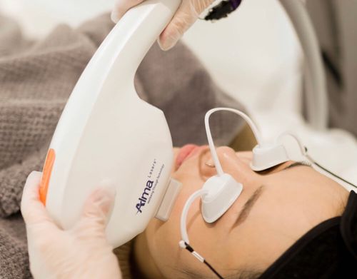 IPL photofacial and aesthetic laser treatment at Dream Skin Lasers, Winter Park, FL