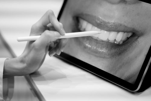 ¿Se puede hacer un diseño de sonrisa sin tallar el diente?