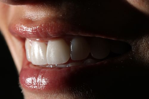 Materiales cerámicos en odontología: cómo seleccionamos la opción adecuada según cada caso.