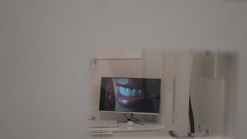 Què és el Mètode Gras® i per què el protocol clínic determina el resultat d'una restauració dental