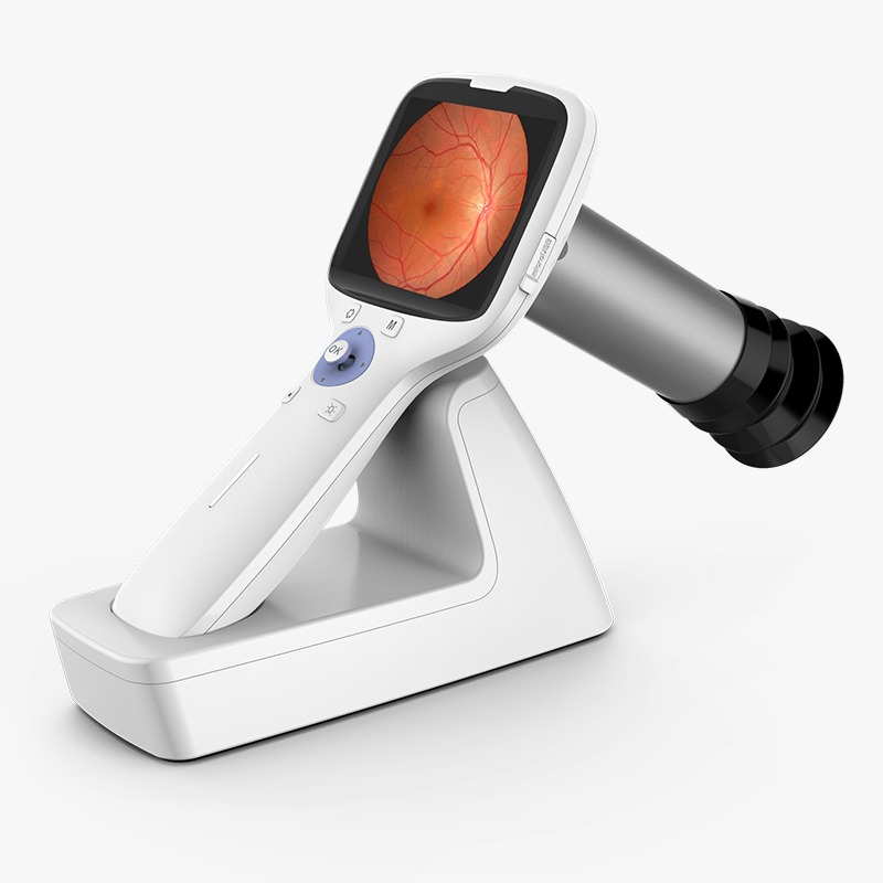 NES-2000 Portable Fundus Camera