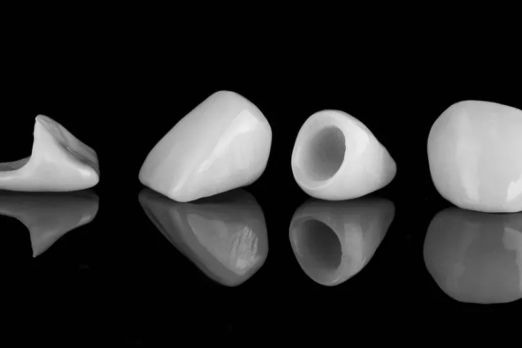 nowoczesna-protetyka-stomatologiczna-korona-porcelanowa