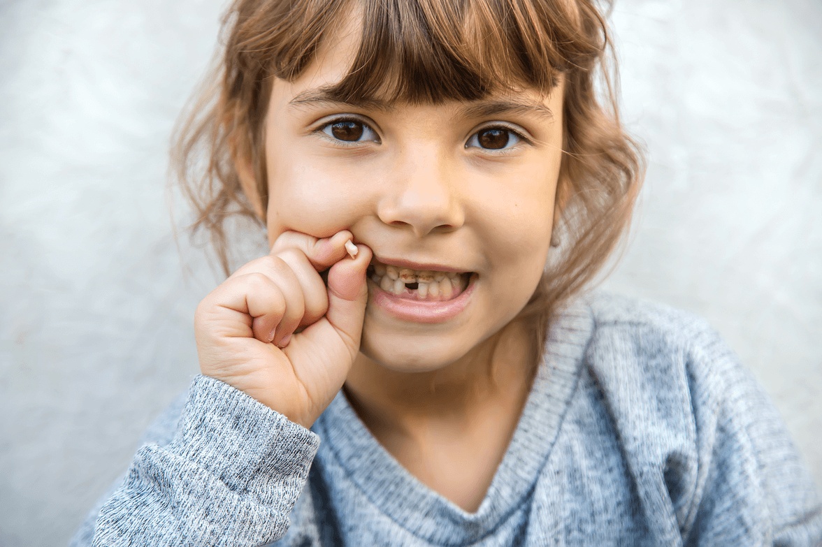 Smiling child holding a recently knocked-out tooth, illustrating what to do after dental trauma and where to find the best pediatric dentist in Anchorage for urgent care.