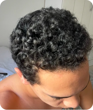 Lucas Queiroz depois do tratamento